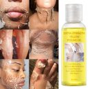 التقشير الأصفر (Yellow Peeling)